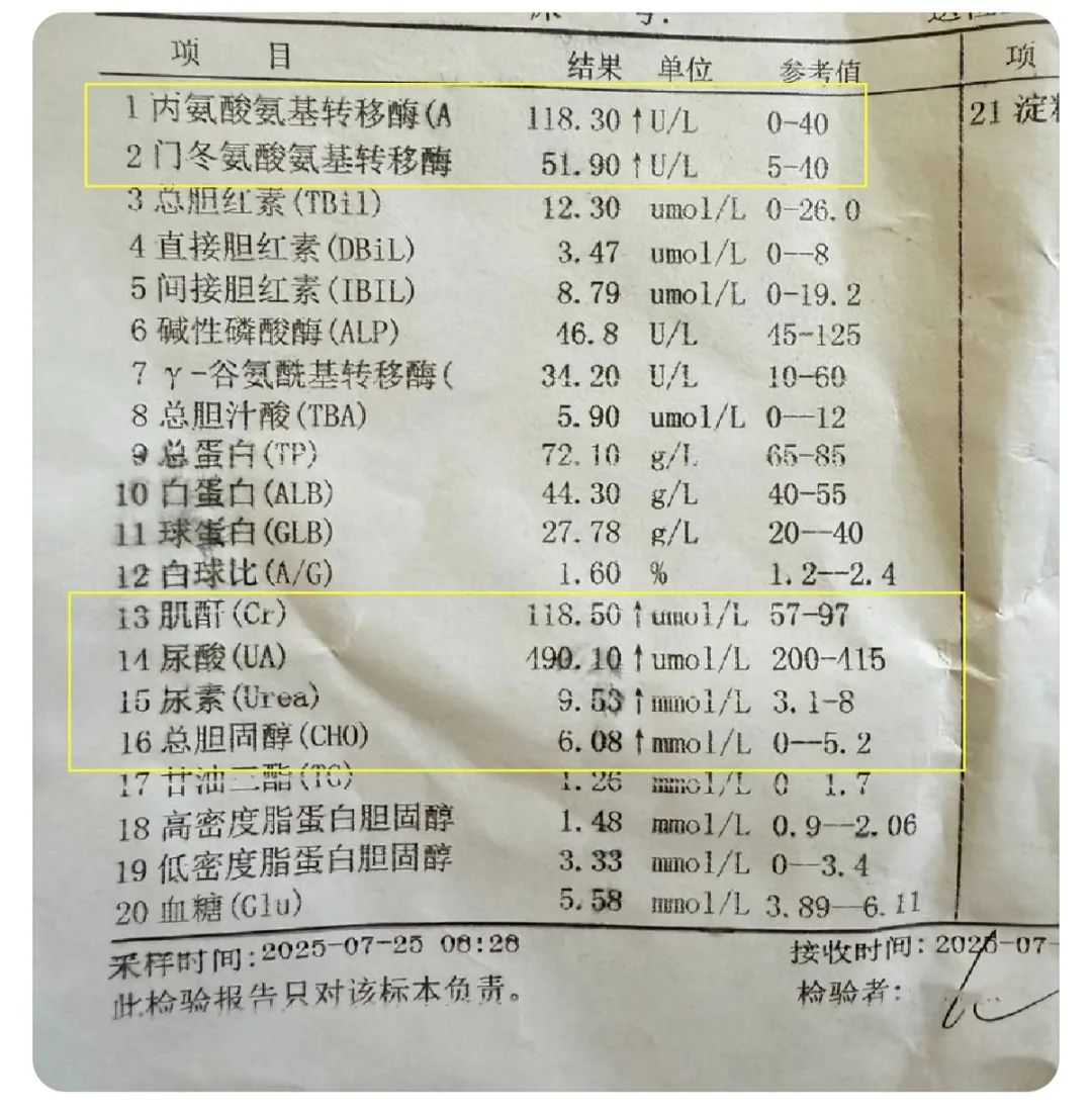 基友自曝服用 PrEP+ 多西环素造成肝肾损伤? 基友自曝服用 PrEP+ 多西环素造成肝肾损伤?